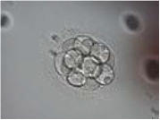 Embryon au stade de 16 cellules, 96 heures