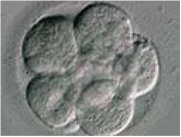 Embryon au stade de 8 cellules, 72 heures